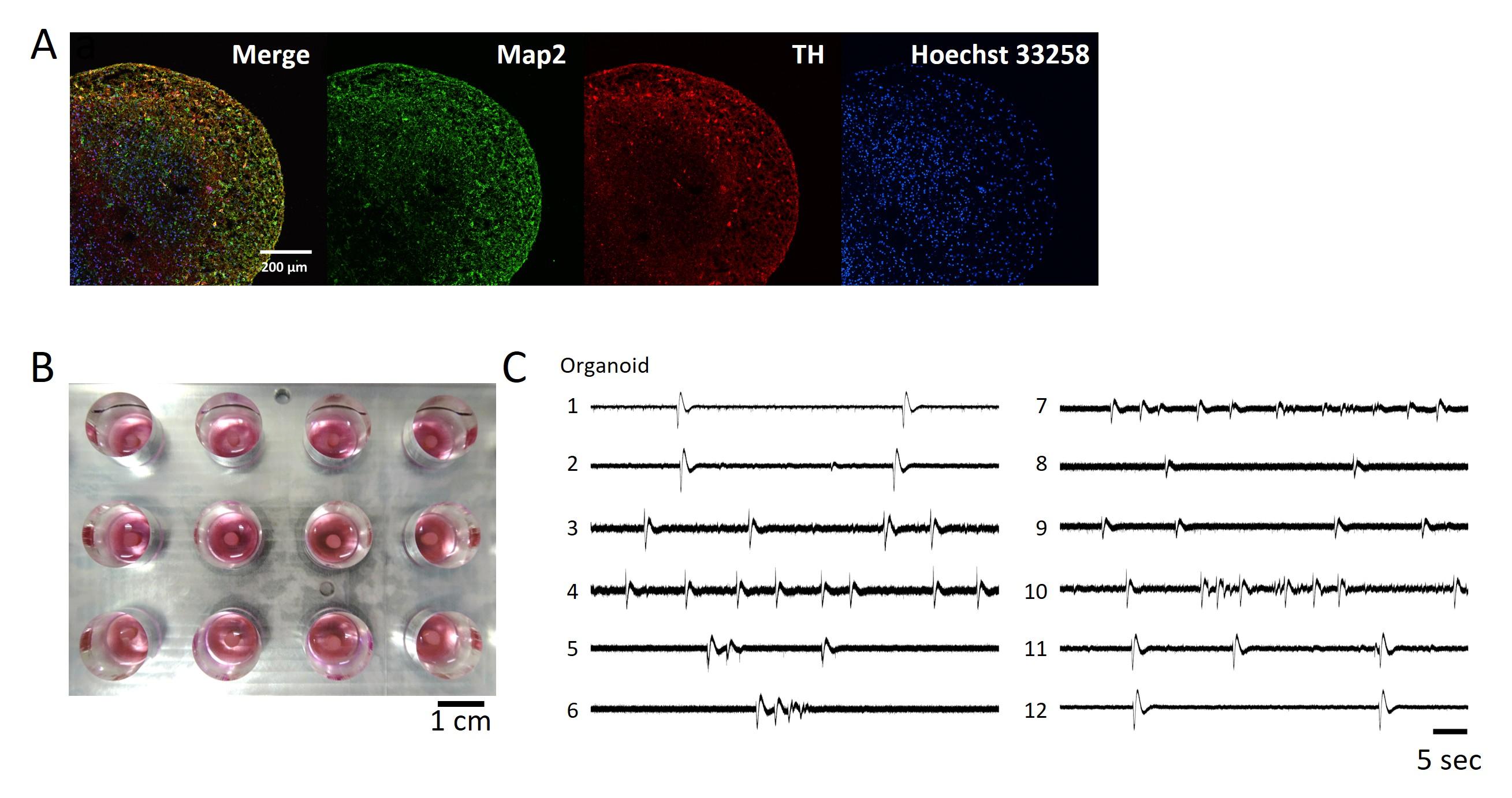 fig1_organoid_rv.jpg